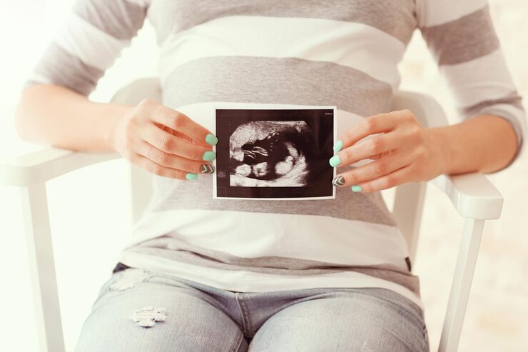 3D/4D Sonography